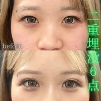 画像1607：施術事例