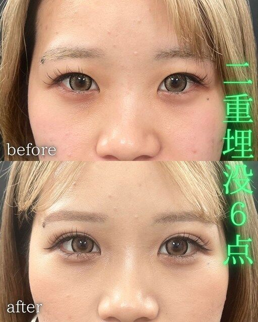 multi_image